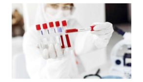 शिमला में आज कोरोना के आये 9 नये मामले